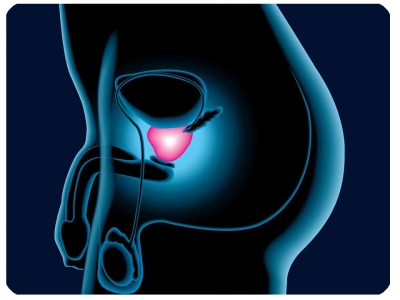 prostatitis naturheilkunde távolítsa el a gyulladást krónikus prosztatitisben